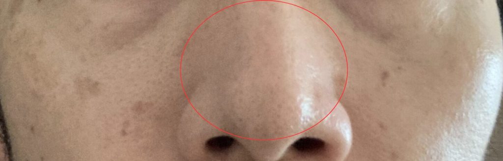 BBクリーム使用前