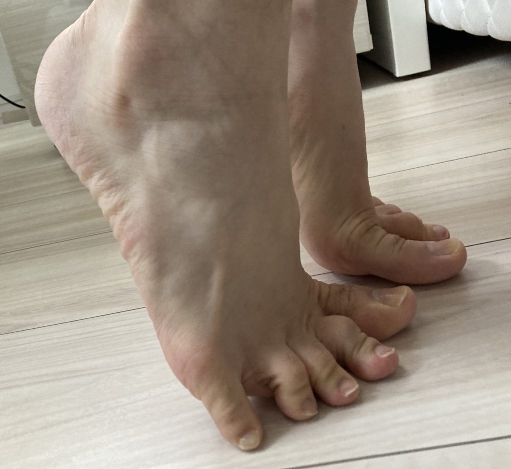 かかと落とし体操1