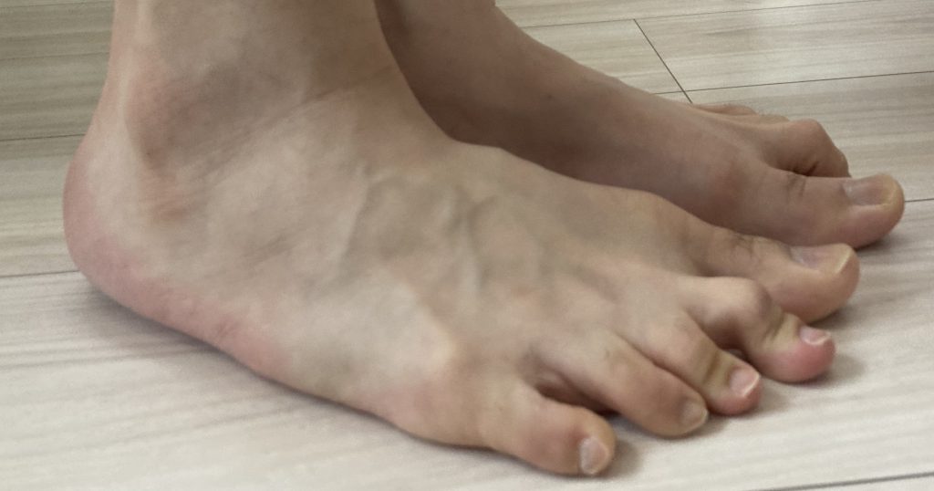 かかと落とし体操2